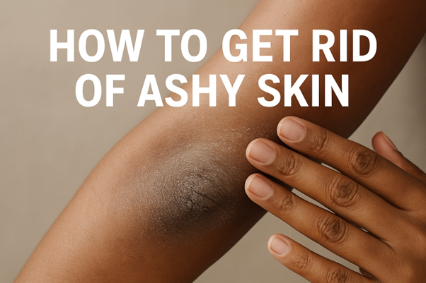HOW TO GET RID OF ASHY SKIN