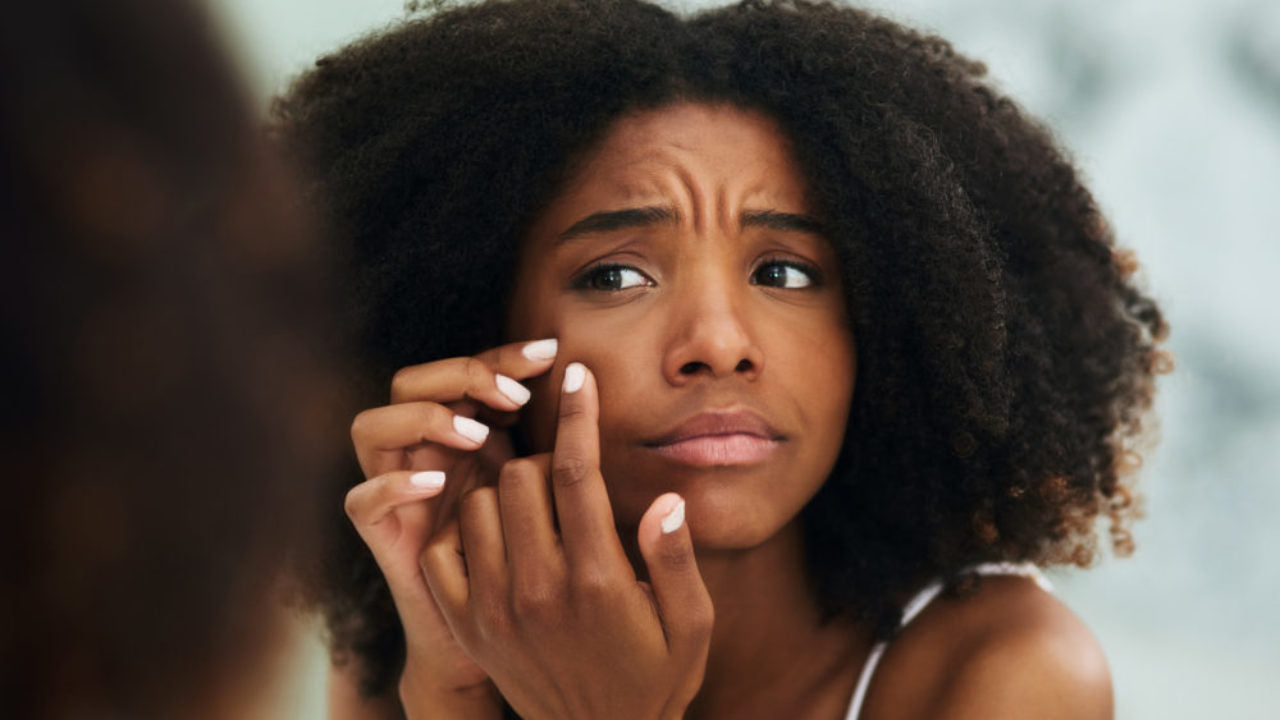 The Clean Beauty Movement - Acne Awareness Month