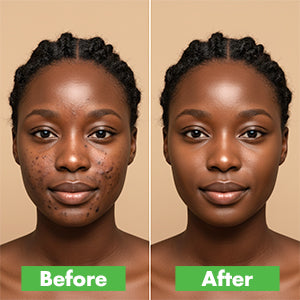 aloe vera plant on face before and after Urban Hydration Aloe Vera Leaf Fade Dark Spot Cream