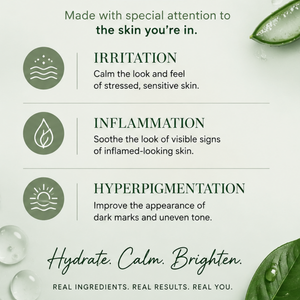Urban Hydration Aloe Vera Moisturize & Treat 2pc Set-Face Moisturizer & Spot Cream